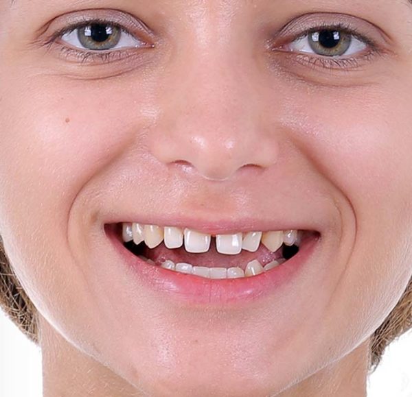 Zähne machen lassen Türkei Istanbul Cosmedica Dental Clinic