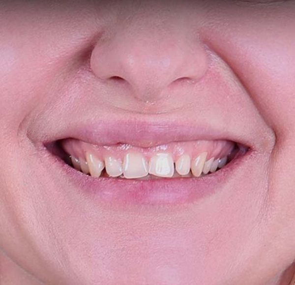 Zähne machen lassen Türkei Istanbul Cosmedica Dental Clinic