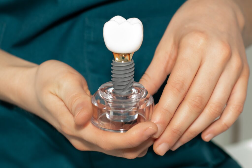 Dentist holding a dental implant; stages of a tooth implant