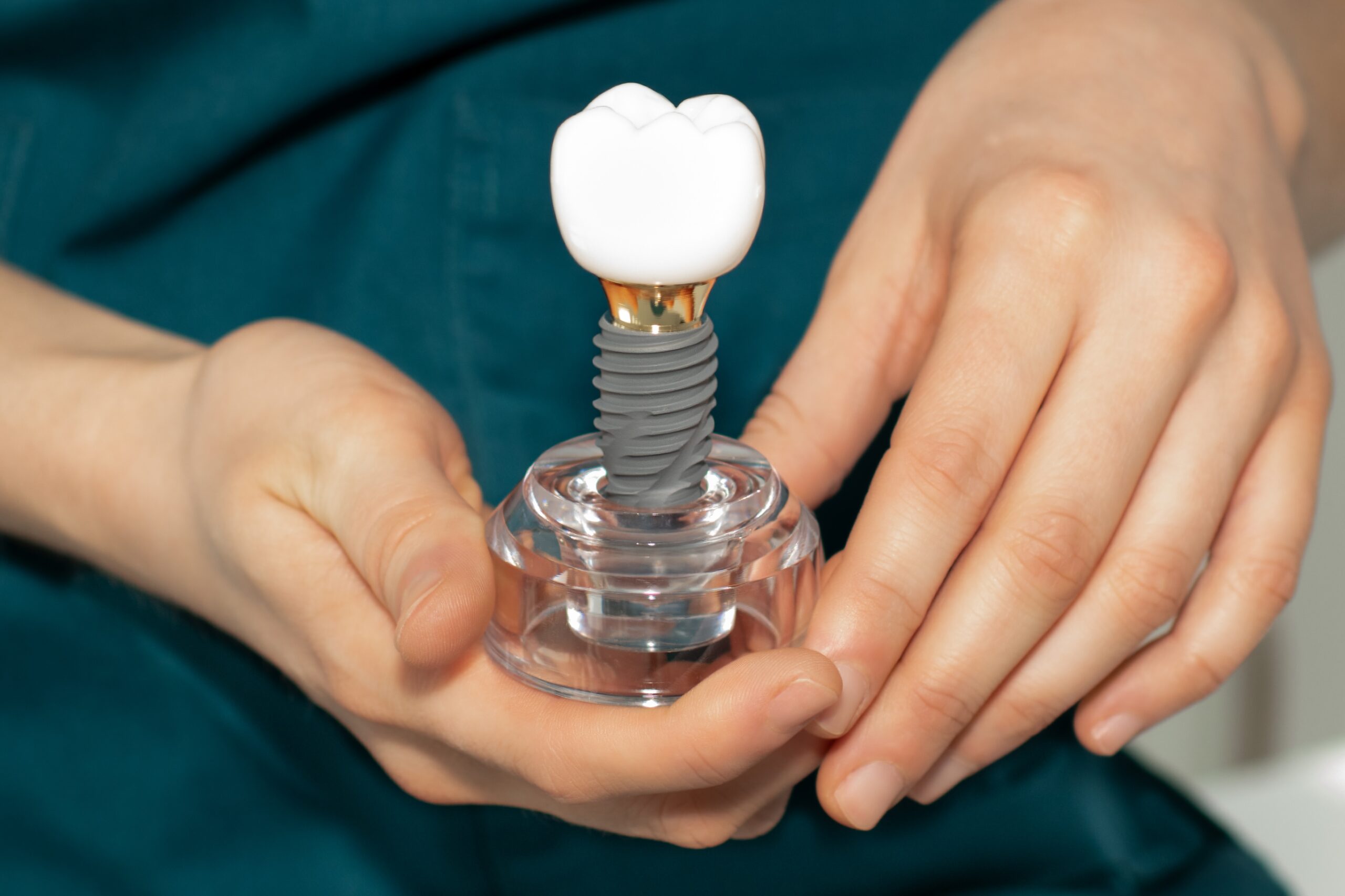 Dentist holding a dental implant; stages of a tooth implant