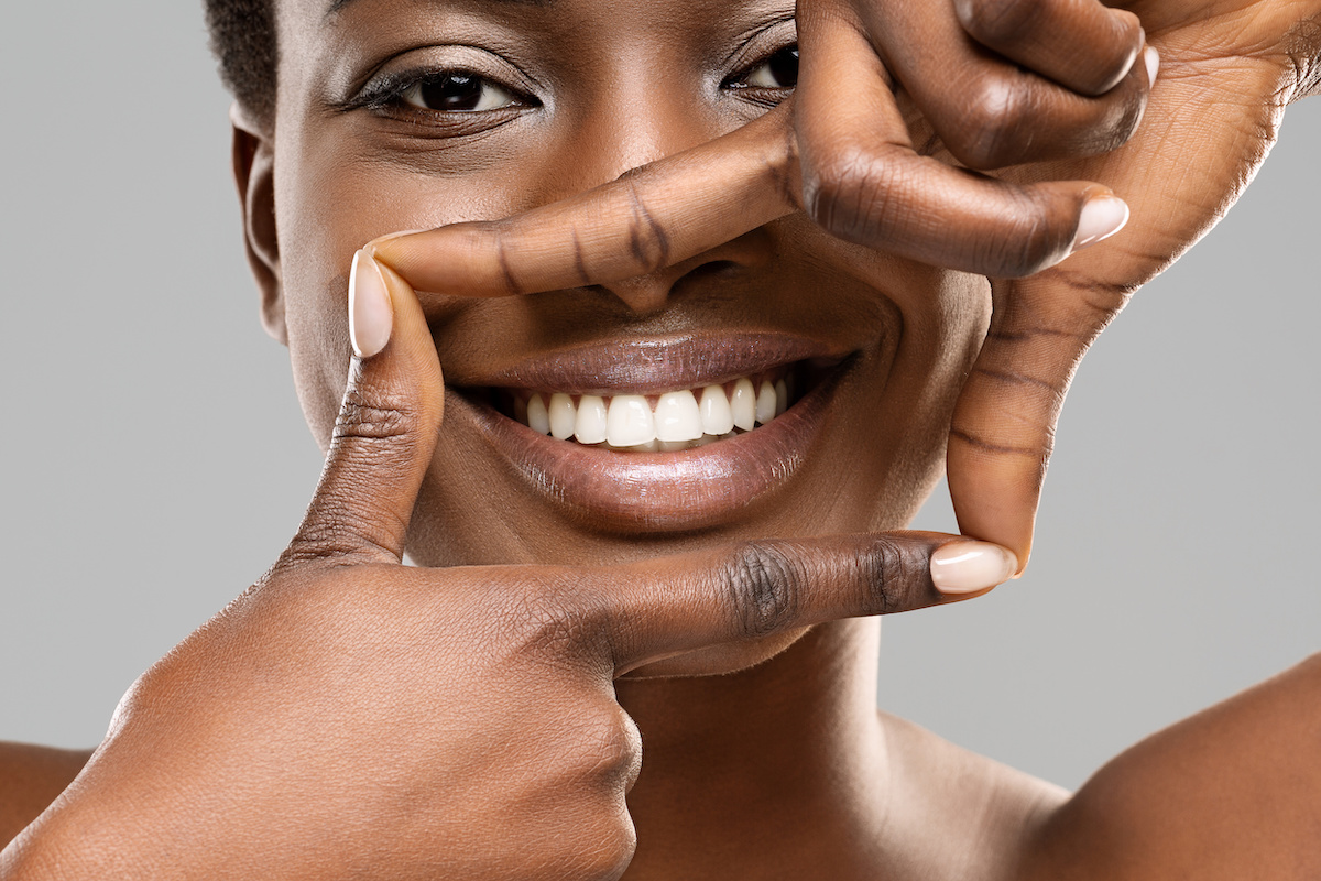 How to get white teeth in one day: black woman framing her smile with her fingers