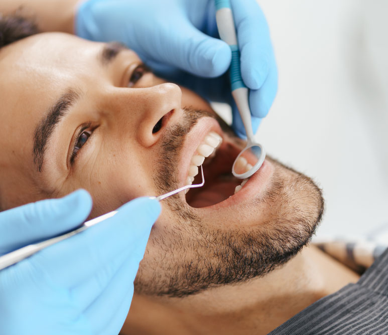 Man has mouth wide open dentist checking his mouth