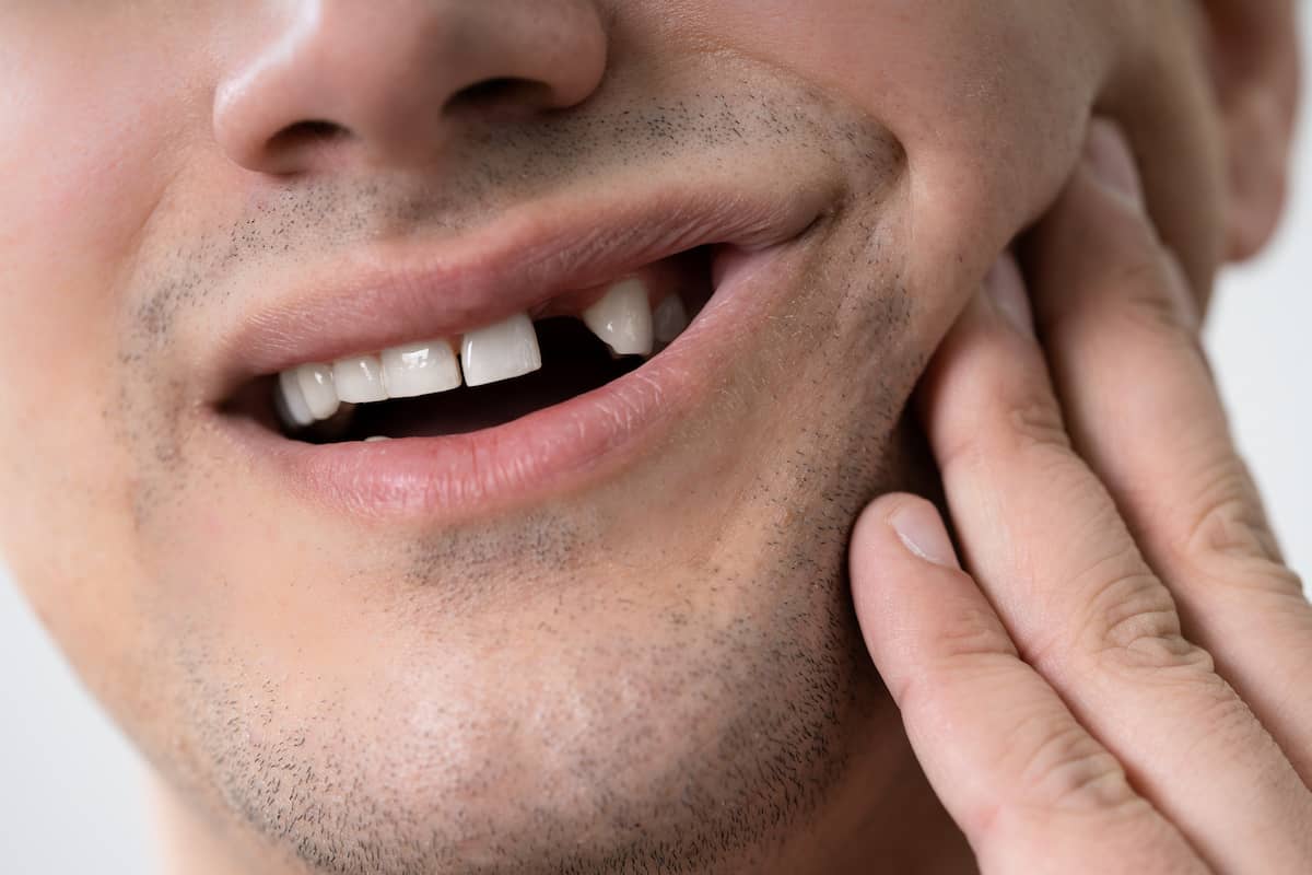 Man with missing front tooth
