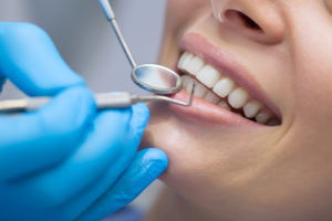 Zahnarzt untersucht die Zähne einer weiblichen Patientin vor der Behandlung