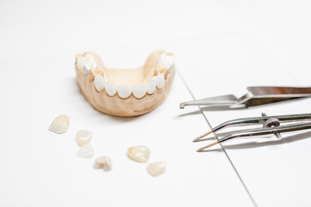 Artificial plaster jaw model with veneers