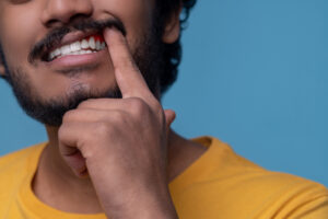 Adult man showing his periodontitis before the camera; periodontitis treatment