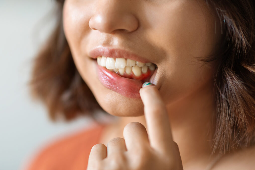 Young woman with bump on gums