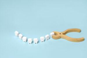 Künstliche Zähne auf einem hellblauen Untergrund; Zange; was sollte man nach Zahnextraktion essen