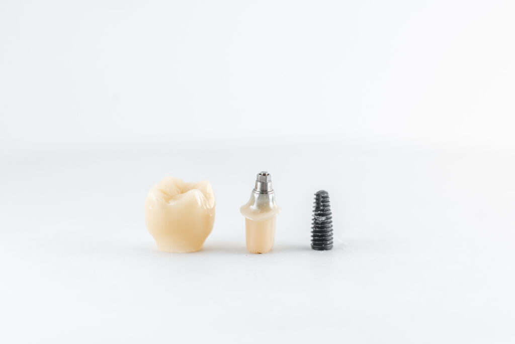 Dental implants in Turkey; cost