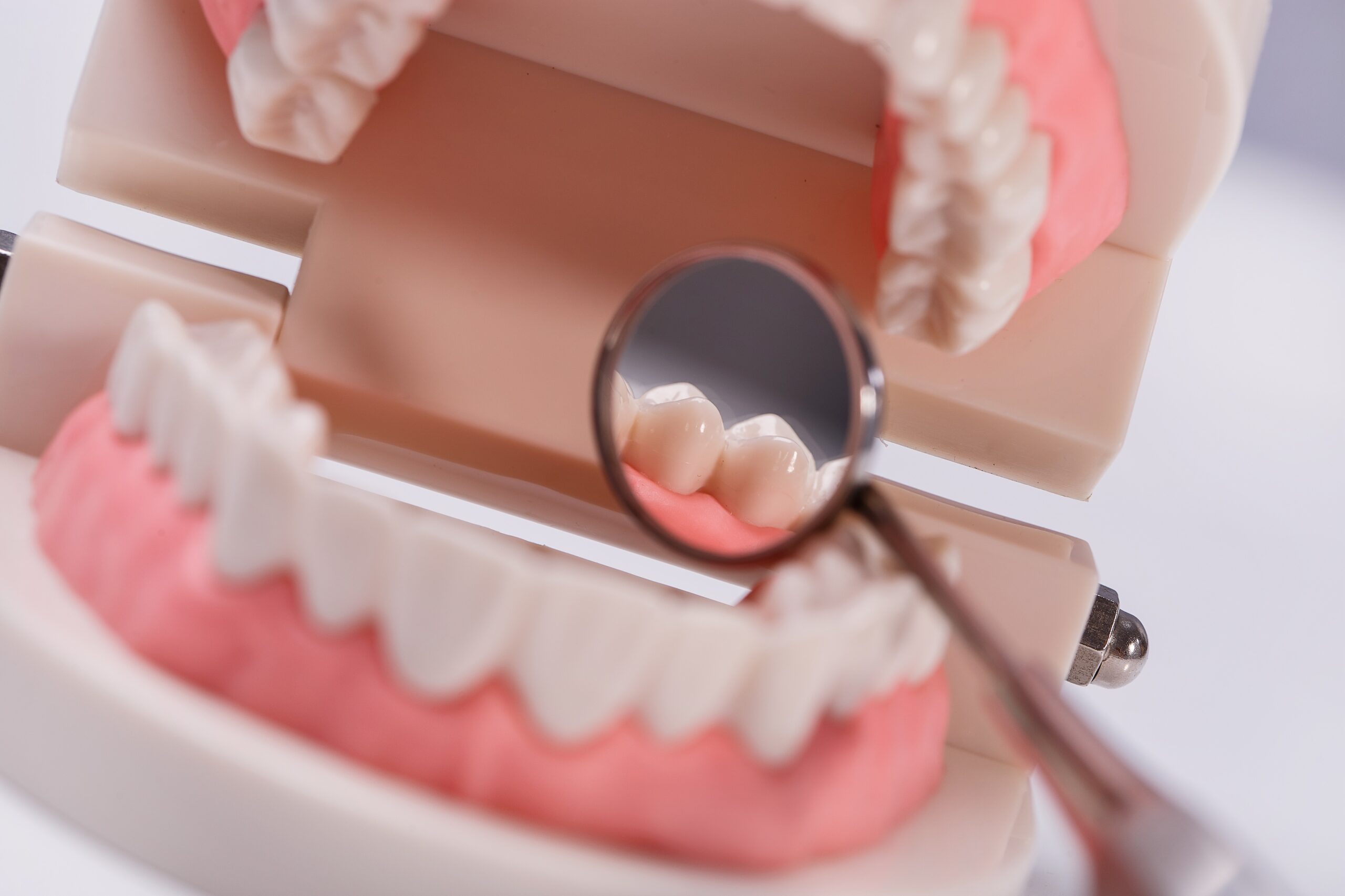 Gum transplantation in Turkey