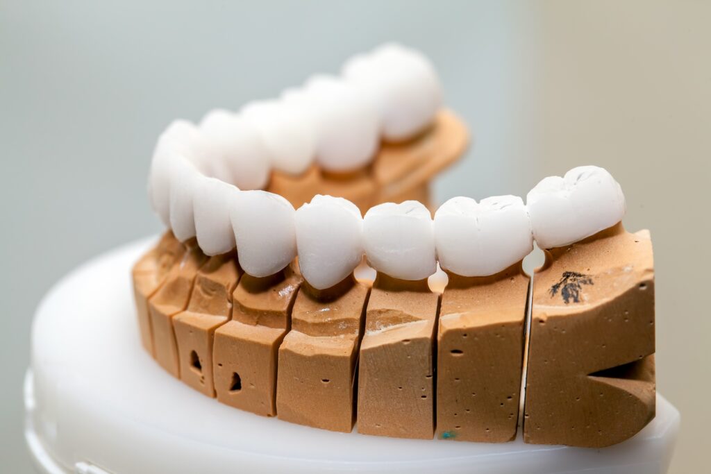 Benefits of Zirconia Veneers