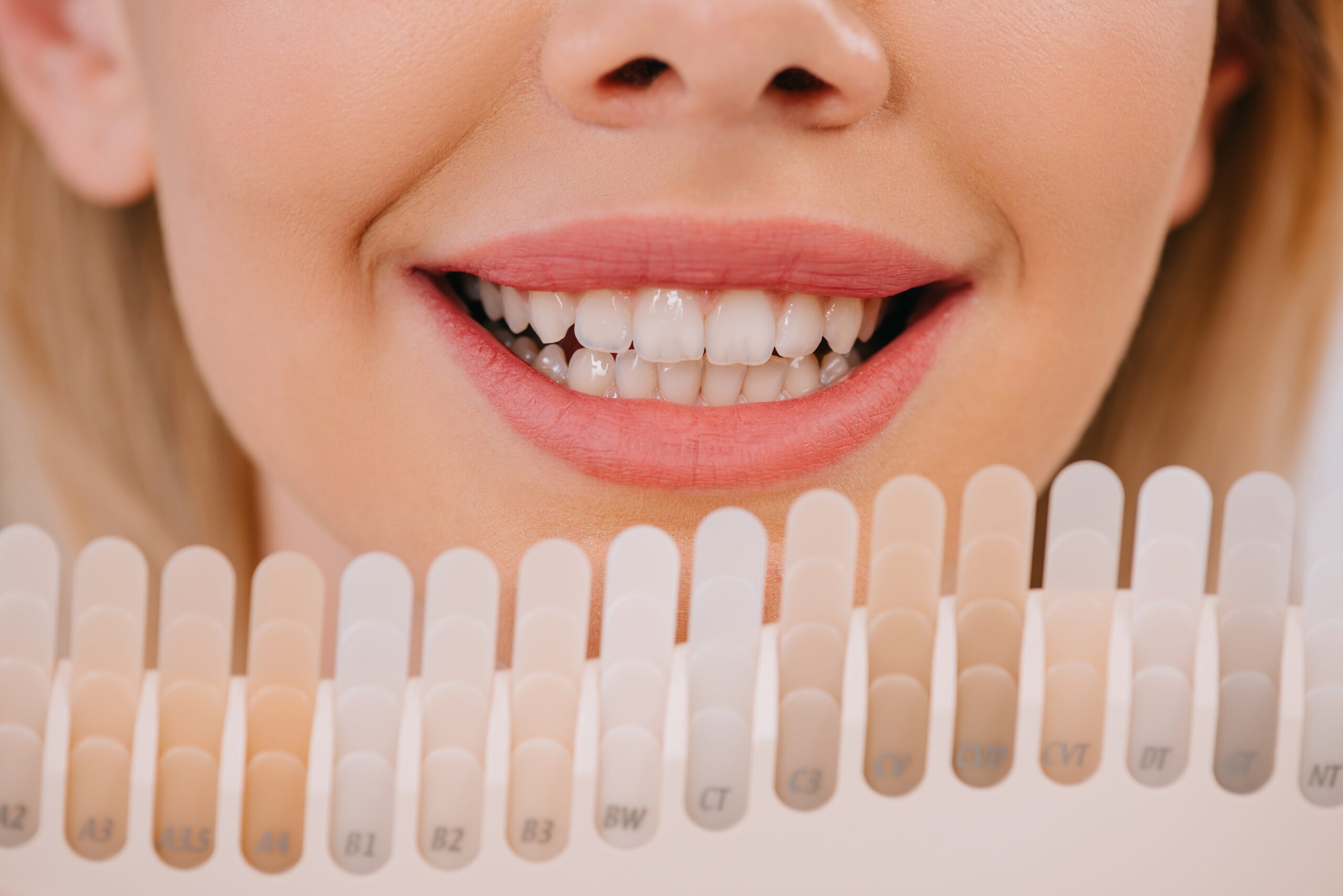 Methods of teeth whitening in Turkey