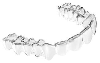 What are the advantages of transparent aligners_