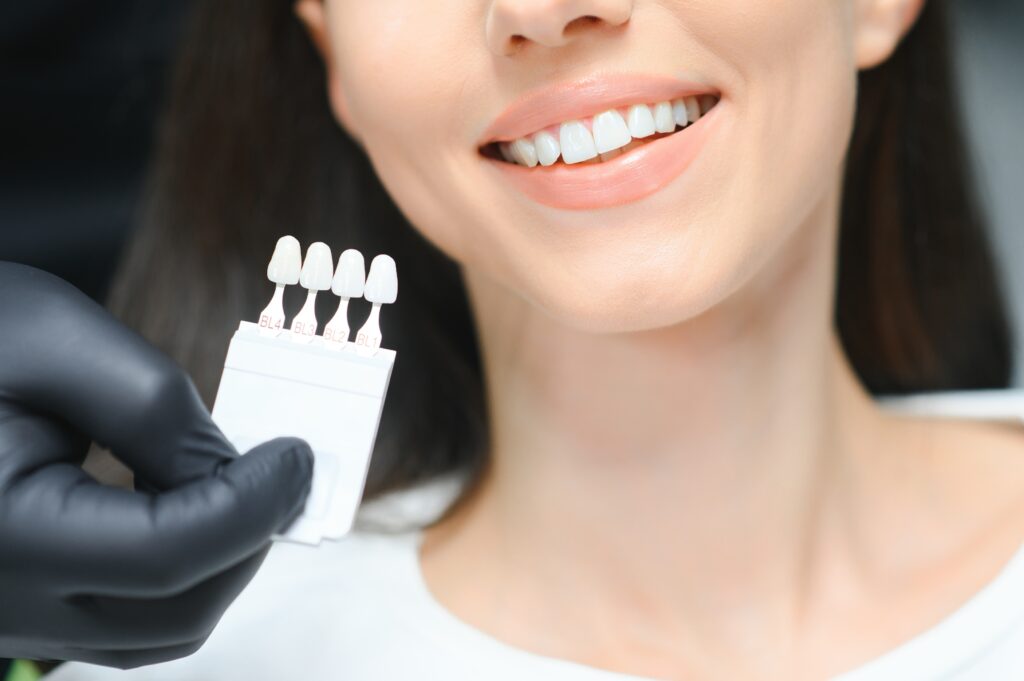 Doctor matching patient's teeth color with no prep veneers in Turkey