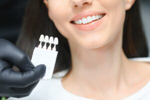 Zahnpalette bei Non-Prep-Veneers in der Türkei