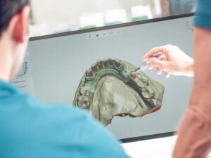 Technologie CAO FAO pour les traitements dentaires