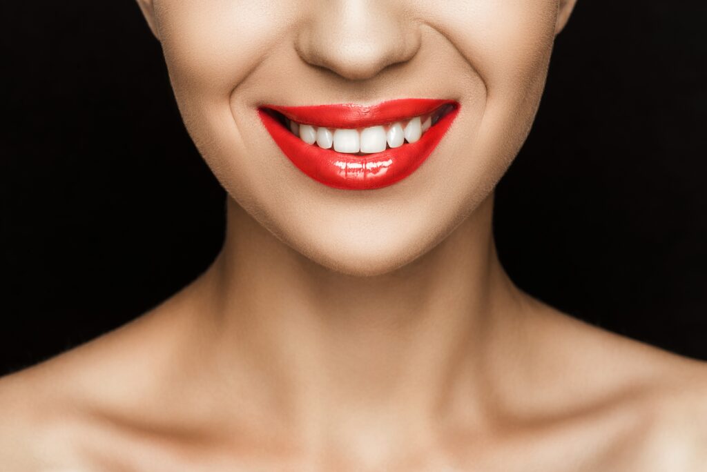 Young girl with a Hollywood Smile Dental Innovation in Turkey and Red lipstick