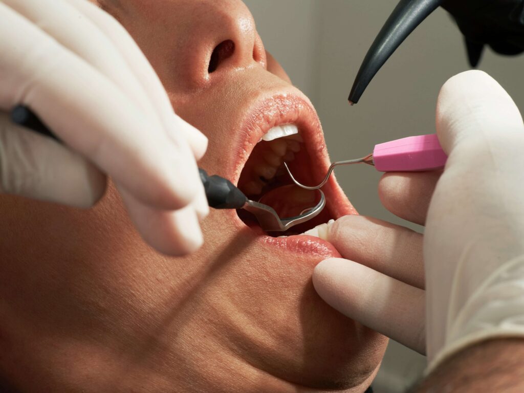 dentiste examinant une couronne dentaire